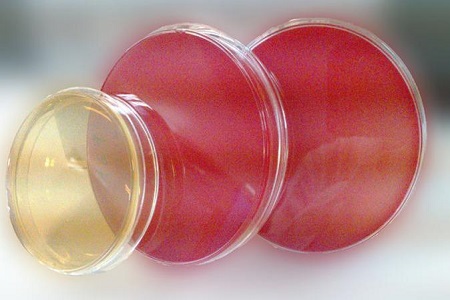 Salmonella Shigella Agar (SS): патогендік оқшаулау үшін маңызды орта