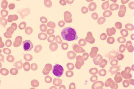 Бабио Giemsa-ның жоғары сапалы дақ ерітіндісін жаһандық зертханалар үшін ашады