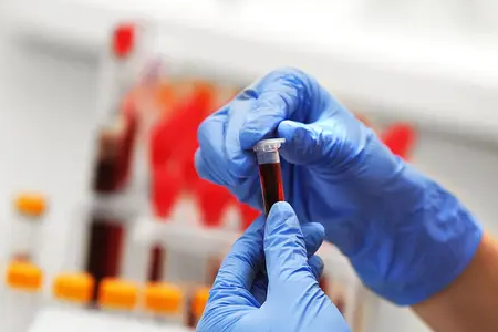 BABIO флуоресцентті ірі қара жүктілігінің жылдам тестін іске қосады