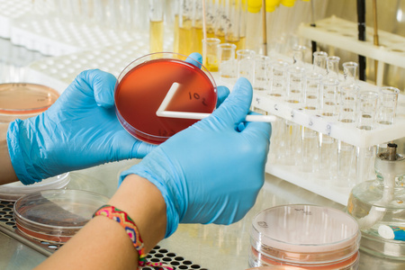 BABIO’s MacConkey агар ортасы – жаһандық микробиологиялық диагностикаға арналған премиум селективті оқшаулау